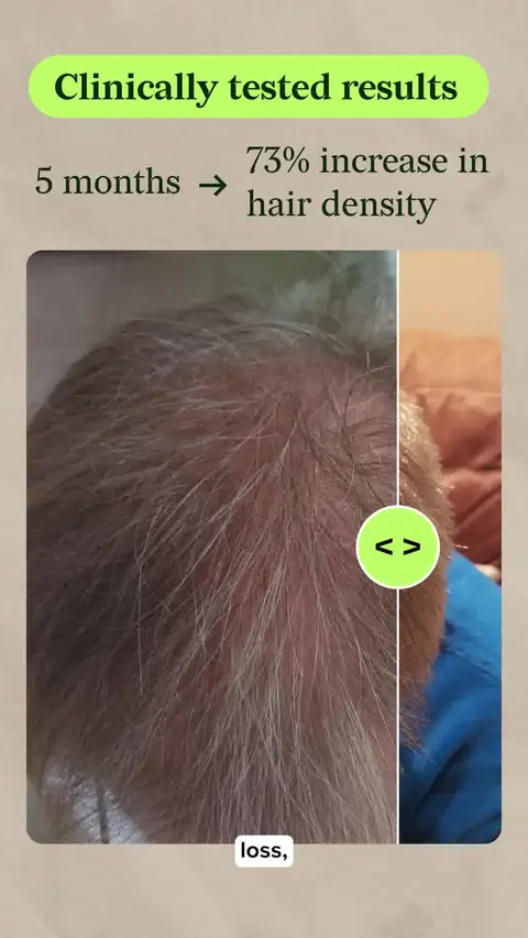 Scandinavian Biolabs ad: Real Results with Our Clinically-Tested Routine