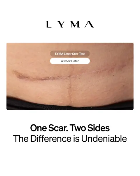 LYMA ad: One Scar. Two Sides. See the Difference.