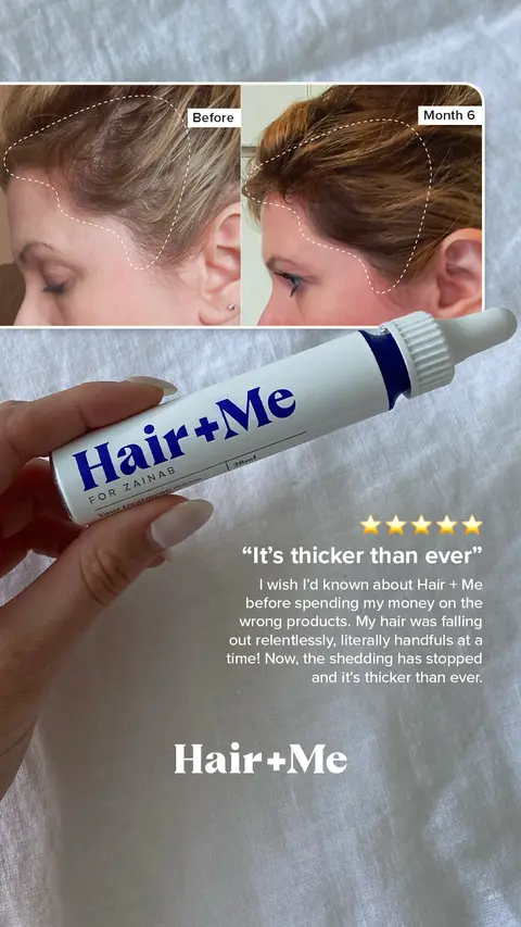 Hair + Me ad: Get ahead of hair loss with Hair + Me