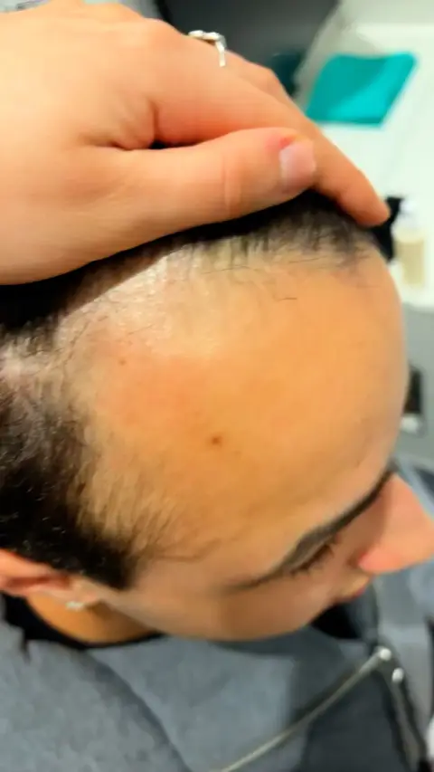 MenofManual ad: A New Era for Hair Treatments