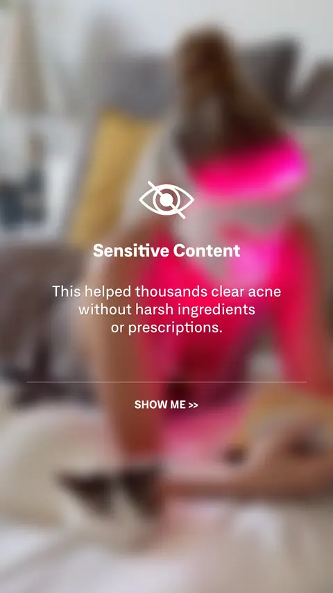 Omnilux ad: Clearer, Smoother, Brighter Skin
