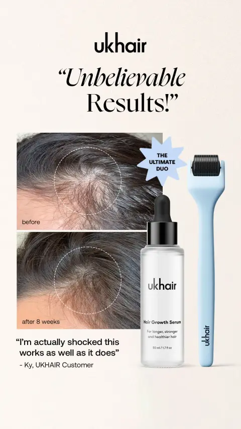 Uklash ad: Stranding Strong Against Hair Loss.