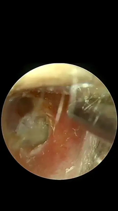 Slivor ad: Tinnitus Isn't Always Nerve Damage