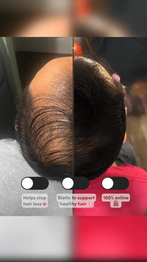 hims ad: Take control of hair loss today